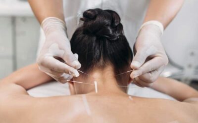 Overcoming Acupuncture Fears: Why You Shouldn’t Be Afraid to Try It