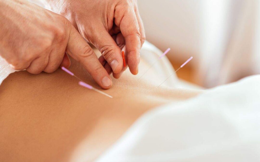 Optimizing the Follicular Phase with Acupuncture: Boosting Egg Development