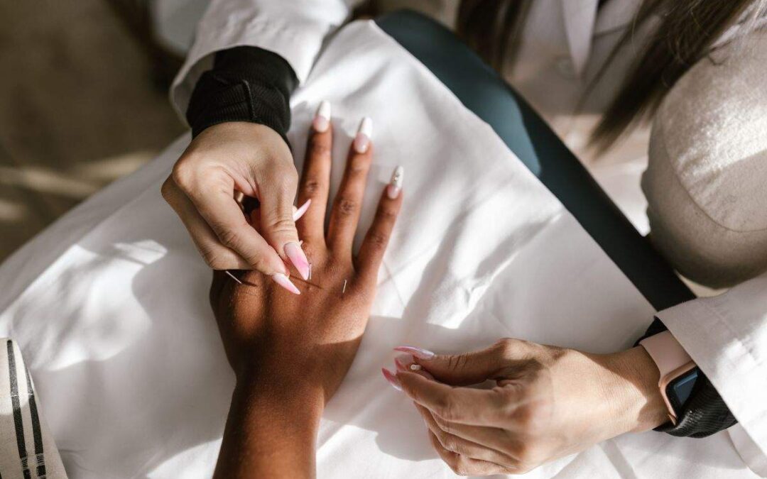 Can Acupuncture Help with Amenorrhea? Restarting the Cycle Naturally