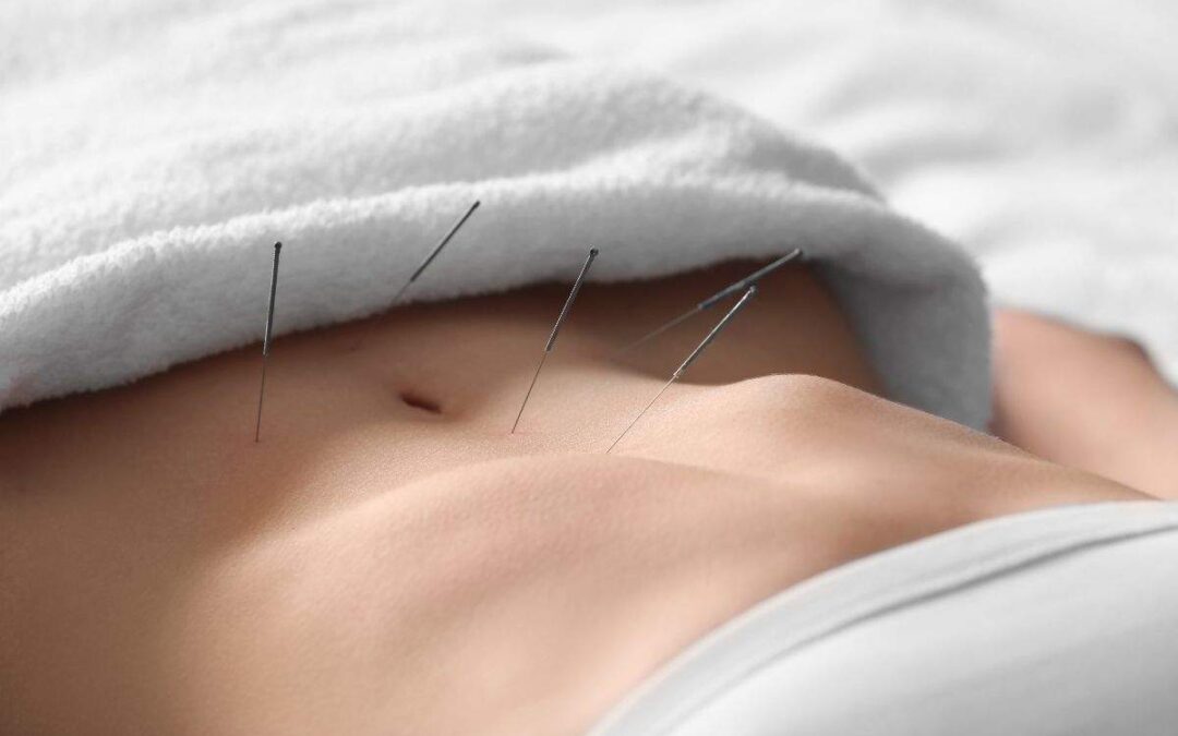 Mind-Body Balance: How Acupuncture Addresses the Psychological Impact of Infertility