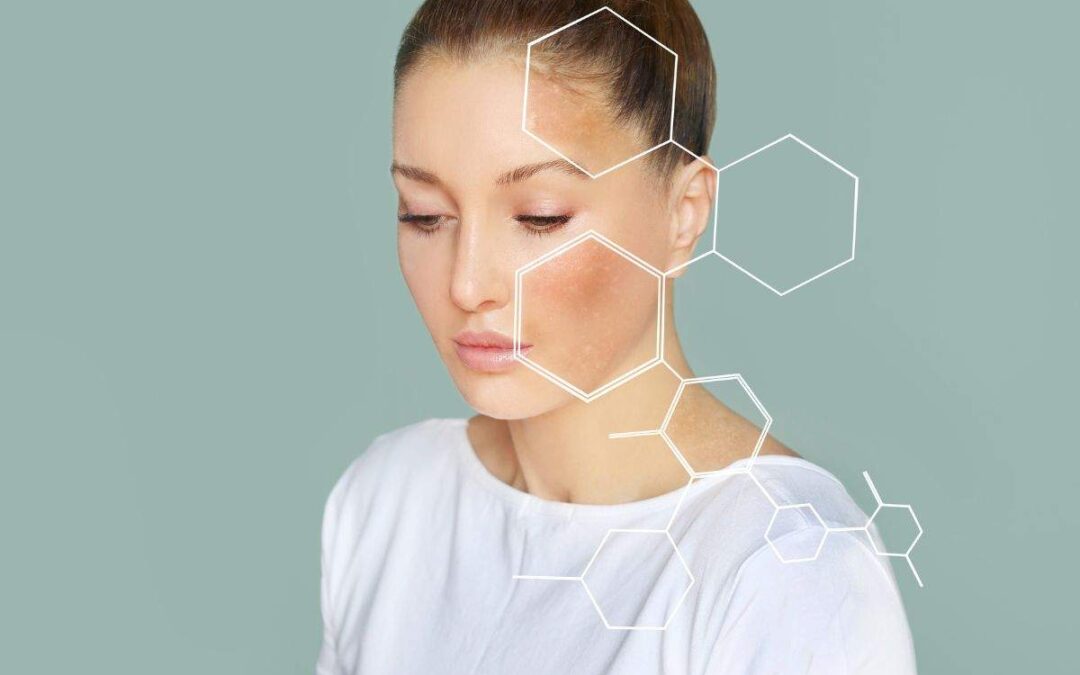 Sun Damage, Wrinkles & Discoloration—Here’s How UltraSlim® Can Help Repair It All