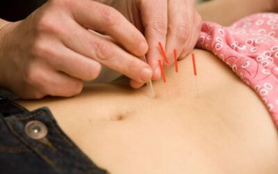 Fertility Roadblocks Doctors Often Overlook—and How Fertility Acupuncture in Boca Raton Brings Them to Light