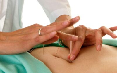 Why Do So Many Couples Turn to Acupuncture for Fertility Support?