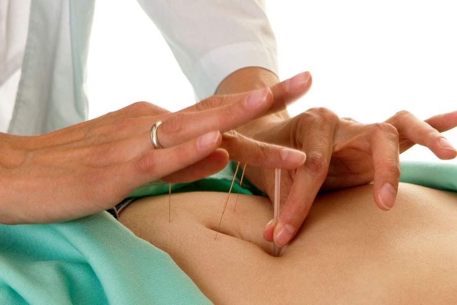Why Do So Many Couples Turn to Acupuncture for Fertility Support?