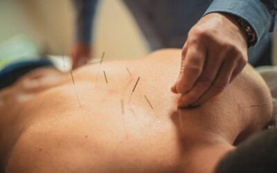 Acupuncture for Low Motility: Helping Sperm Move Stronger