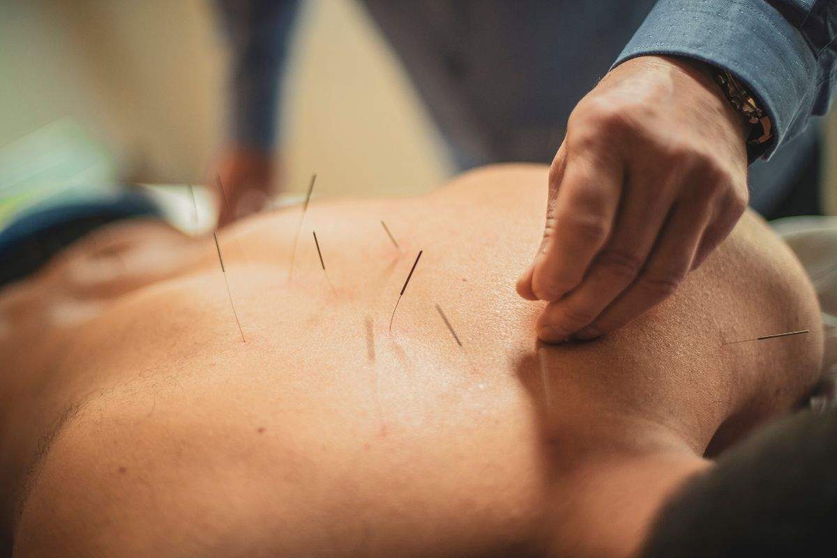Acupuncture for Low Sperm Motility