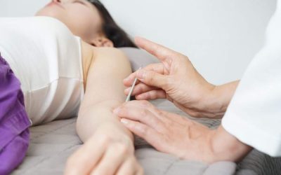 Reducing Fertility Related Stress at Family Gatherings with Acupuncture